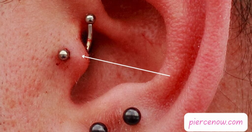 Tragus Piercing Benefits What You Need to Know